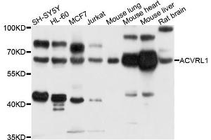Western blot analysis of extracts of various cell lines, using ACVRL1 antibody (ABIN5996082) at 1/1000 dilution. (ACVRL1 抗体)