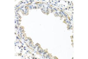 Immunohistochemistry of paraffin-embedded mouse lung using IL22 antibody (ABIN5975407) at dilution of 1/100 (40x lens). (IL-22 抗体)