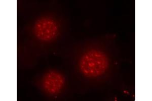 Immunofluorescence analysis of methanol-fixed MCF-7 cells using Phospho-FOXO4-S197 antibody (ABIN3019724, ABIN3019725, ABIN3019726 and ABIN1681609). (FOXO4 抗体  (pSer197))