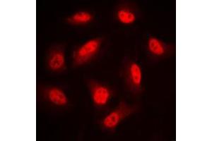 Immunofluorescent analysis of LIMK1/2 (pT508/505) staining in PC12 cells. (LIMK-1/2 (C-Term), (pSer505), (pSer508) 抗体)