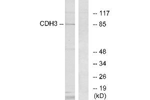 Immunohistochemistry analysis of paraffin-embedded human brain tissue using CDH3 antibody. (P-Cadherin 抗体)