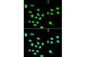 Immunofluorescence analysis of HepG2 cells using FCGR2A antibody (ABIN5970646). (FCGR2A 抗体)