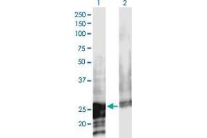 Western Blot analysis of NOL3 expression in transfected 293T cell line by NOL3 monoclonal antibody (M02), clone 3A9. (NOL3 抗体  (AA 1-208))