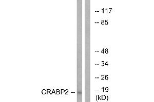 Western blot analysis of extracts from HT-29 cells, using CRABP2 antibody. (CRABP2 抗体)