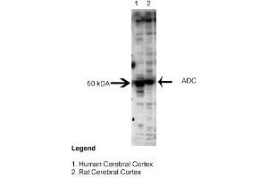 Sample Type: Human and Rat Cerebral CortexPrimary Dilution: 1:3000 (ADC 抗体  (Middle Region))
