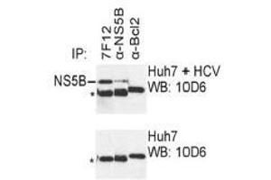 Western Blotting (WB) image for anti-Hepatitis C Virus NS5 (HCV NS5) (AA 77-86) antibody (ABIN781787) (HCV NS5 抗体  (AA 77-86))