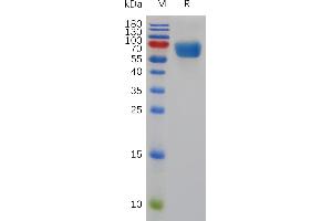 Mouse SL Protein, hFc Tag on SDS-PAGE under reducing condition. (SLAMF1 Protein (AA 30-242) (Fc Tag))