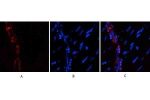 Immunofluorescence analysis of mouse heart tissue. (alpha-SMA (AA 171-220) 抗体)