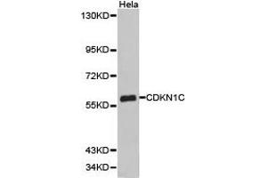 Western Blotting (WB) image for anti-Cyclin-Dependent Kinase Inhibitor 1C (p57, Kip2) (CDKN1C) antibody (ABIN1871758) (CDKN1C 抗体)