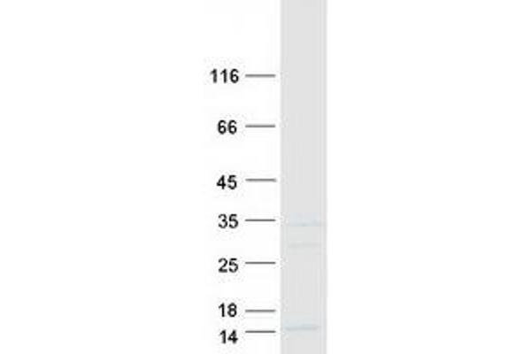 SS18L2 Protein (Myc-DYKDDDDK Tag)