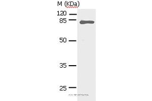 Western blot analysis of Human fetal lung tissue, using STAT5A Polyclonal Antibody at dilution of 1:450 (STAT5A 抗体)