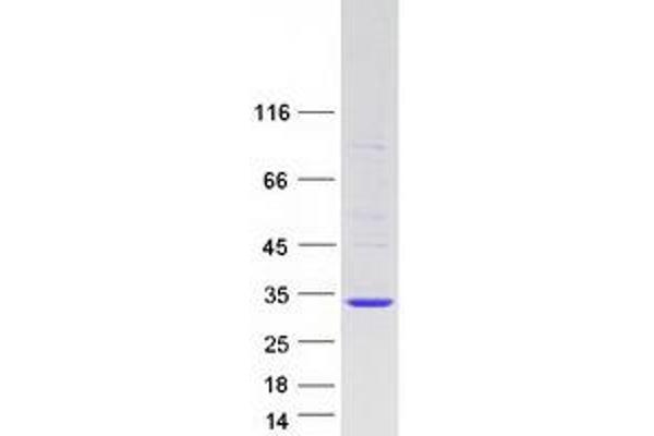 RRAS2 Protein (Transcript Variant 1) (Myc-DYKDDDDK Tag)