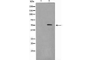 Western blot analysis of MEN1 expression in HuvEc cells,The lane on the left is treated with the antigen-specific peptide. (Menin 抗体  (Internal Region))