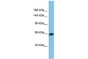 Host:  Rabbit  Target Name:  TPO  Sample Type:  Jurkat Whole Cell lysates  Antibody Dilution:  1. (Thyroperoxidase 抗体  (N-Term))