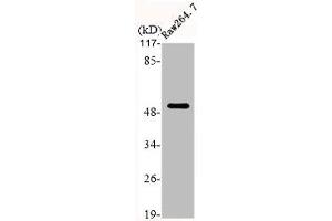 Western Blot analysis of RAE264. (Cytokeratin 7 抗体  (C-Term))