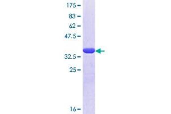 VAPB Protein (AA 121-204) (GST tag)