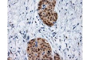 Immunohistochemical staining of paraffin-embedded Kidney tissue using anti-IFT57 mouse monoclonal antibody. (IFT57 抗体)