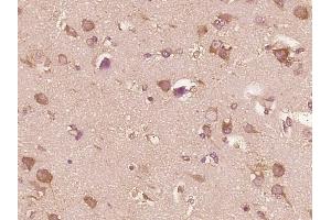 Immunohistochemistry (Paraffin-embedded Sections) (IHC (p)) image for anti-Interleukin 13 (IL13) (AA 45-56) antibody (ABIN670116)