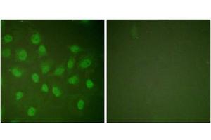 Immunofluorescence analysis of HeLa cells, treated with PMA (125ng/ml, 30mins), using POLR2A (epitope around residue 1619) antibody (ABIN5976162). (POLR2A/RPB1 抗体  (Ser1619))