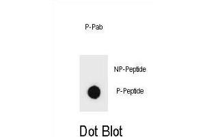 Dot blot analysis of Phospho-PTEN- Antibody Phospho-specific Pab (ABIN6241049 and ABIN6578935) on nitrocellulose membrane. (PTEN 抗体  (pSer362))