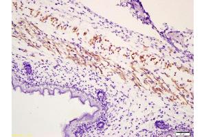 Formalin-fixed and paraffin embedded mouse embryonic muscle labeled with Anti-Phospho-MYL(Ser19) Polyclonal Antibody, Unconjugated (ABIN744188) at 1:200 followed by conjugation to the secondary antibody and DAB staining (PML 抗体  (pSer19))