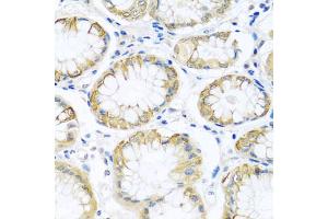 Immunohistochemistry of paraffin-embedded human stomach using PCDHA12 antibody. (PCDHA12 抗体)