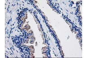 Immunohistochemistry (IHC) image for anti-TBC1 Domain Family, Member 21 (TBC1D21) antibody (ABIN1501312) (TBC1D21 抗体)