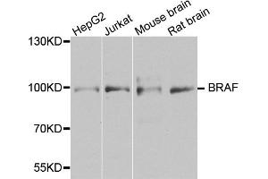 Western blot analysis of extracts of various cell lines, using BRAF antibody (ABIN5974879) at 1/1000 dilution. (BRAF 抗体)