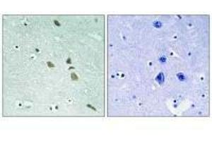 Immunohistochemistry analysis of paraffin-embedded human brain tissue using ILK (Ab-246) antibody. (ILK 抗体  (Ser246))