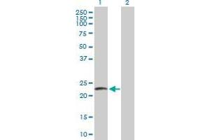 Lane 1: LYZL2 transfected lysate ( 21. (LYZL2 293T Cell Transient Overexpression Lysate(Denatured))