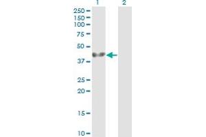 Western Blotting (WB) image for anti-Adhesion Regulating Molecule 1 (Adrm1) (AA 18-407) antibody (ABIN564790)