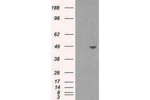 HEK293T cells were transfected with the pCMV6-ENTRY control (Left lane) or pCMV6-ENTRY SORD (Right lane) cDNA for 48 hrs and lysed. (SORD 抗体)