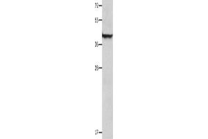 Western Blotting (WB) image for anti-serpin Peptidase Inhibitor, Clade B (Ovalbumin), Member 5 (SERPINB5) antibody (ABIN2428393) (SERPINB5 抗体)