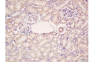 Formalin-fixed and paraffin embedded rat kidney labeled with Rabbit Anti-HER4/ErbB4 Polyclonal Antibody, Unconjugated  at 1:200 followed by conjugation to the secondary antibody and DAB staining (ERBB4 抗体  (AA 451-550))