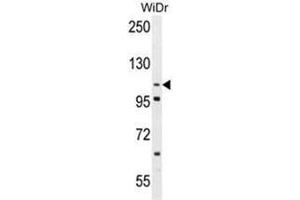 Western blot analysis of ADAM19 Antibody (Center) in WiDr cell line lysates (35 µg/lane). (ADAM19 抗体  (Middle Region))