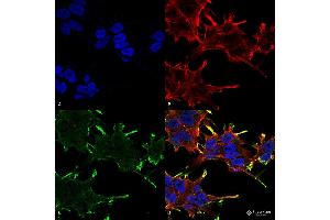Immunocytochemistry/Immunofluorescence analysis using Mouse Anti-Alpha B Crystallin Monoclonal Antibody, Clone 1A7. (CRYAB 抗体  (PerCP))