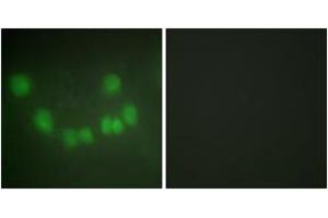 Immunofluorescence analysis of HuvEc cells, using CDC2 Antibody. (CDK1 抗体  (AA 101-150))