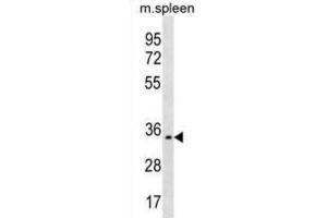 Western Blotting (WB) image for anti-Triggering Receptor Expressed On Myeloid Cells-Like 1 (TREML1) antibody (ABIN3000417) (TREML1 抗体)