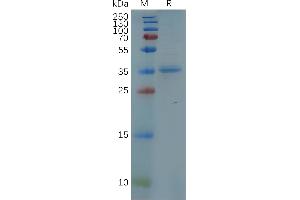 Human C Protein, hFc Tag on SDS-PAGE under reducing condition. (CXCR5 Protein (AA 1-53) (Fc Tag))