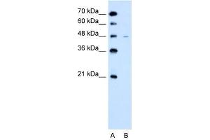 WB Suggested Anti-SLC43A3  Antibody Titration: 2. (SLC43A3 抗体  (N-Term))