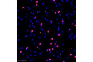 Immunofluorescence of paraffin embedded mouse brain using kb12 (ABIN7075406) at dilution of 1:700 (300x lens) (p130 抗体)