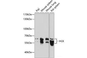 Western blot analysis of extracts of various cell lines using HCK Polyclonal Antibody at dilution of 1:1000. (HCK 抗体)