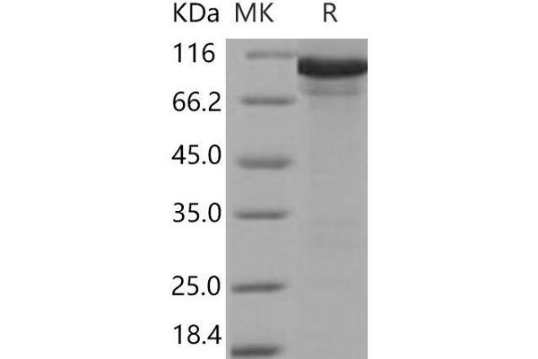 AARS Protein (His tag)