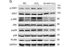 The expression of PLIN5 was regulated by the JNK-p38-ATF pathway. (MAPK14 抗体  (C-Term))
