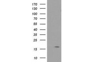 Image no. 1 for anti-Baculoviral IAP Repeat-Containing 5 (BIRC5) antibody (ABIN1501247) (Survivin 抗体)