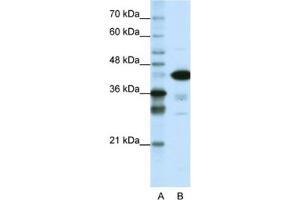 Western Blotting (WB) image for anti-TAR DNA Binding Protein (TARDBP) antibody (ABIN2461819) (TARDBP 抗体)
