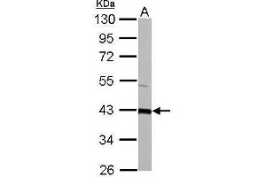 WB Image GOT2 antibody detects GOT2 protein by Western blot analysis. (GOT2 抗体  (Center))