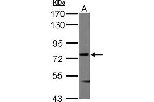 Western Blotting (WB) image for anti-Multiple Endocrine Neoplasia 1 (MEN1) (AA 71-407) antibody (ABIN1499428) (Menin 抗体  (AA 71-407))