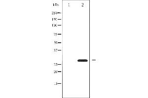 Western blot analysis of BCL-2 phosphorylation expression in nocodazole treated HeLa whole cell lysates,The lane on the left is treated with the antigen-specific peptide. (Bcl-2 抗体  (pSer87))
