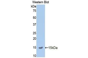 Detection of Recombinant APP, Mouse using Polyclonal Antibody to Amyloid Precursor Protein (APP) (APP 抗体  (AA 672-711))